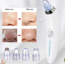 Derma Suction Facial Cleanser